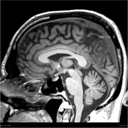 Ранняя диагностика нейродегенеративных заболеваний в КардиоКлинике